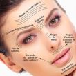 Botox2